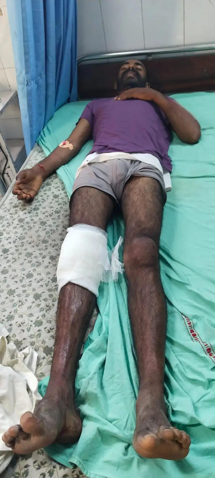 &nbsp;&nbsp;मर्डर व रेप का वांछित कुख्यात आरोपी मुठभेड़ के बाद काबू