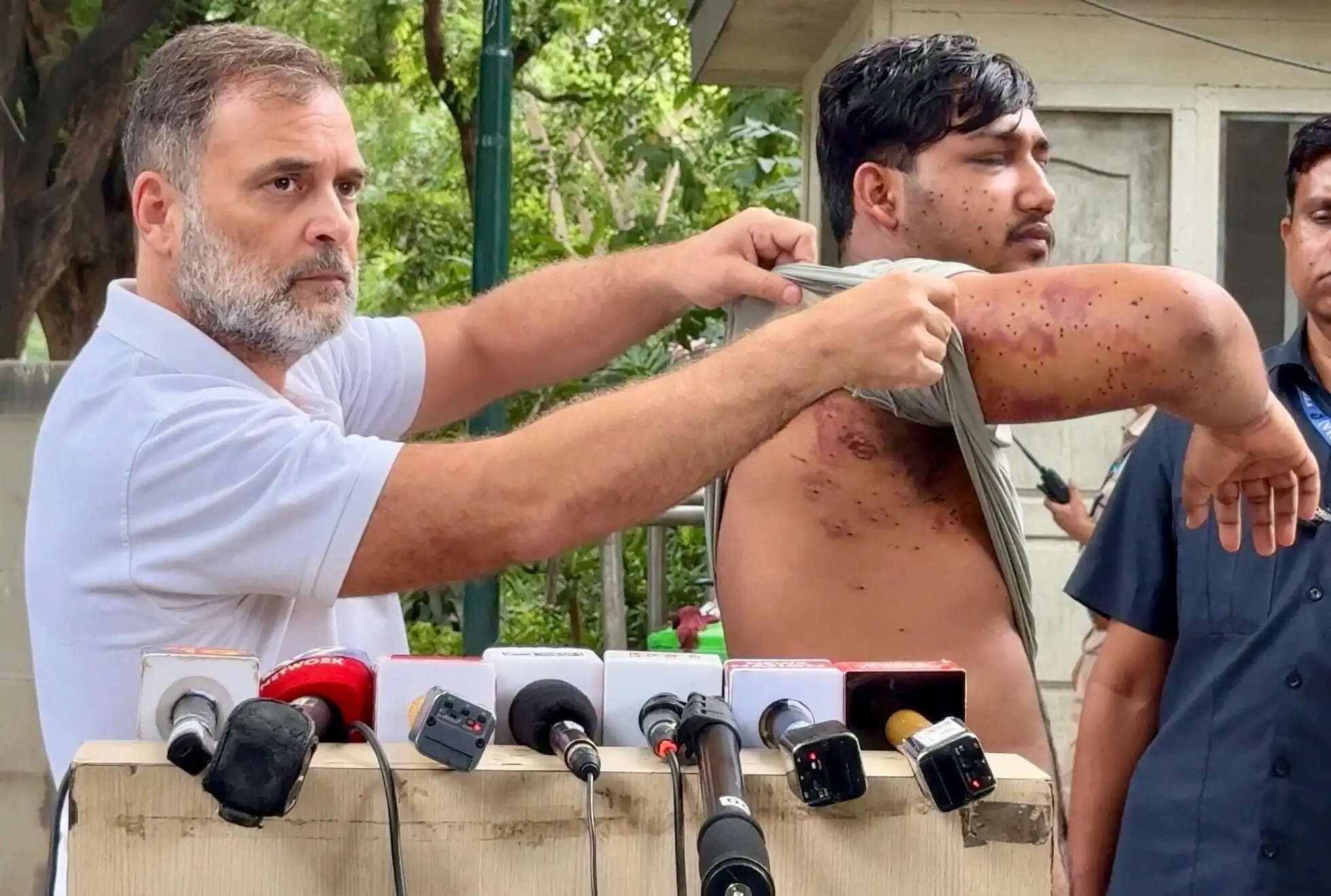 पुलिस कार्रवाई में घायल युवक को सामने लाए राहुल गांधी, बोले- सरकार अत्याचार की जिम्मेदारी ले