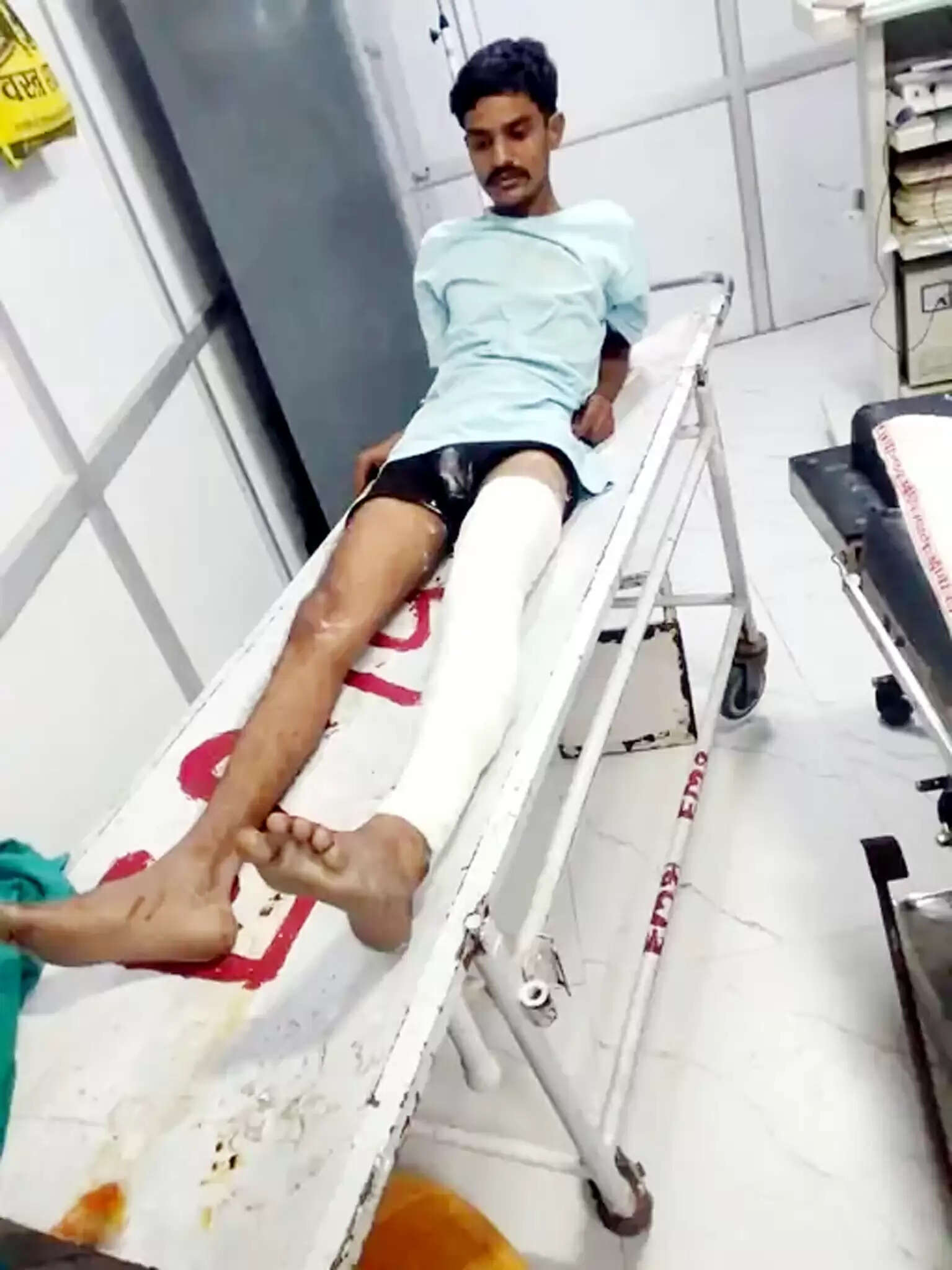 भिवानी कोर्ट फायरिंग का आरोपित फतेहाबाद में मुठभेड़ में घायल, पुलिस ने रोहित को पकड़ा