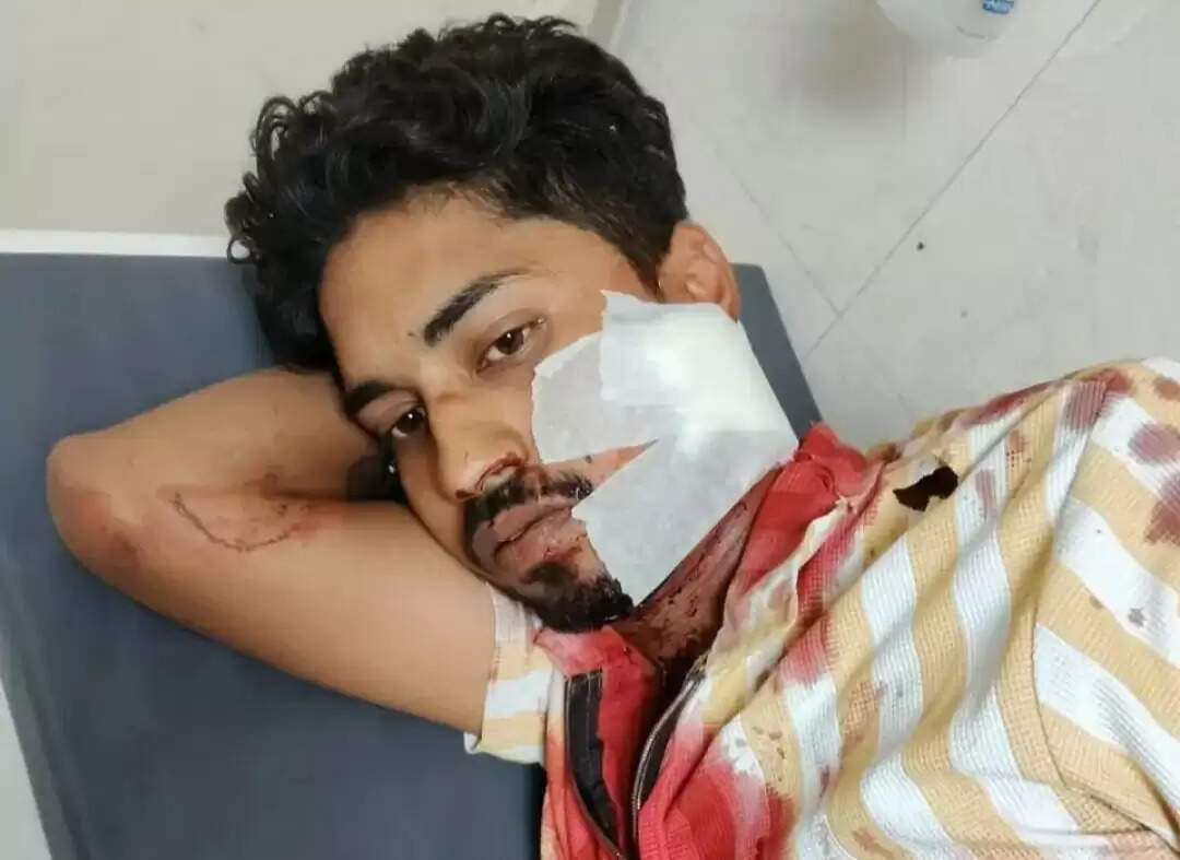   पानीपत में युवक ने अपने दोस्त के गले पर किया चाकू से प्रहार, हालत गंभीर